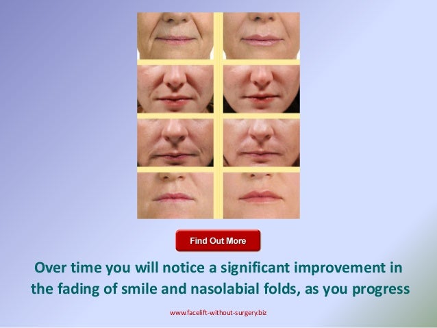 Pantyhose encasement sex Facial exercises for nasolabial folds